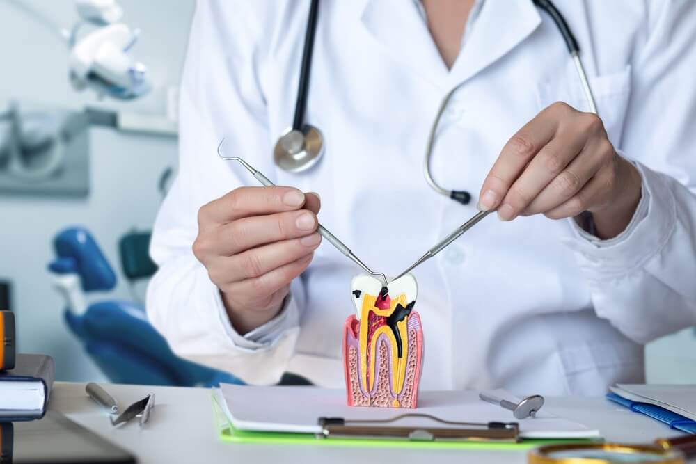 Endodonti (Kanal Tedavisi)