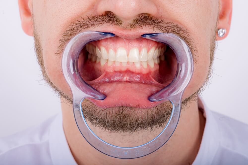 Periodontoloji